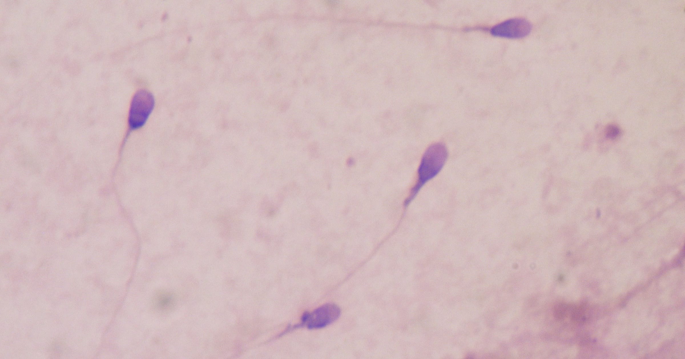 Sex: Engineered for Success