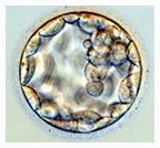 Amniotic Stem Cells