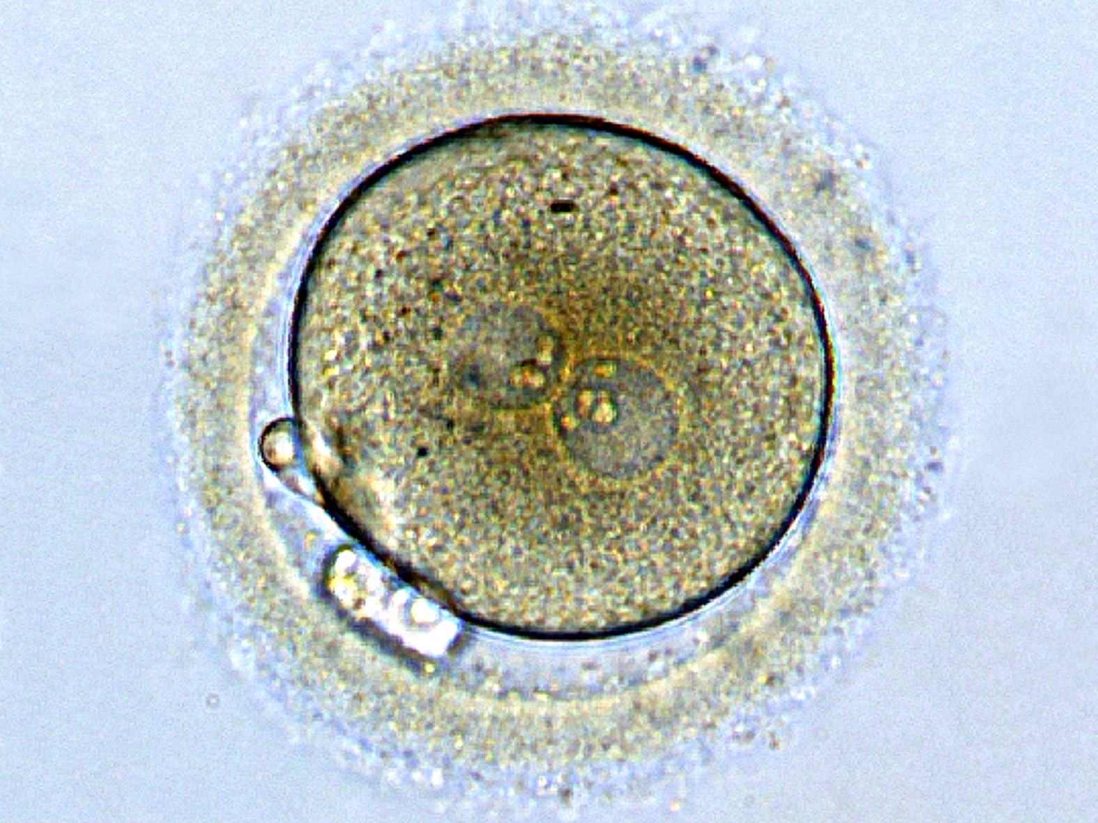 The Zygote Code and Other Mysteries