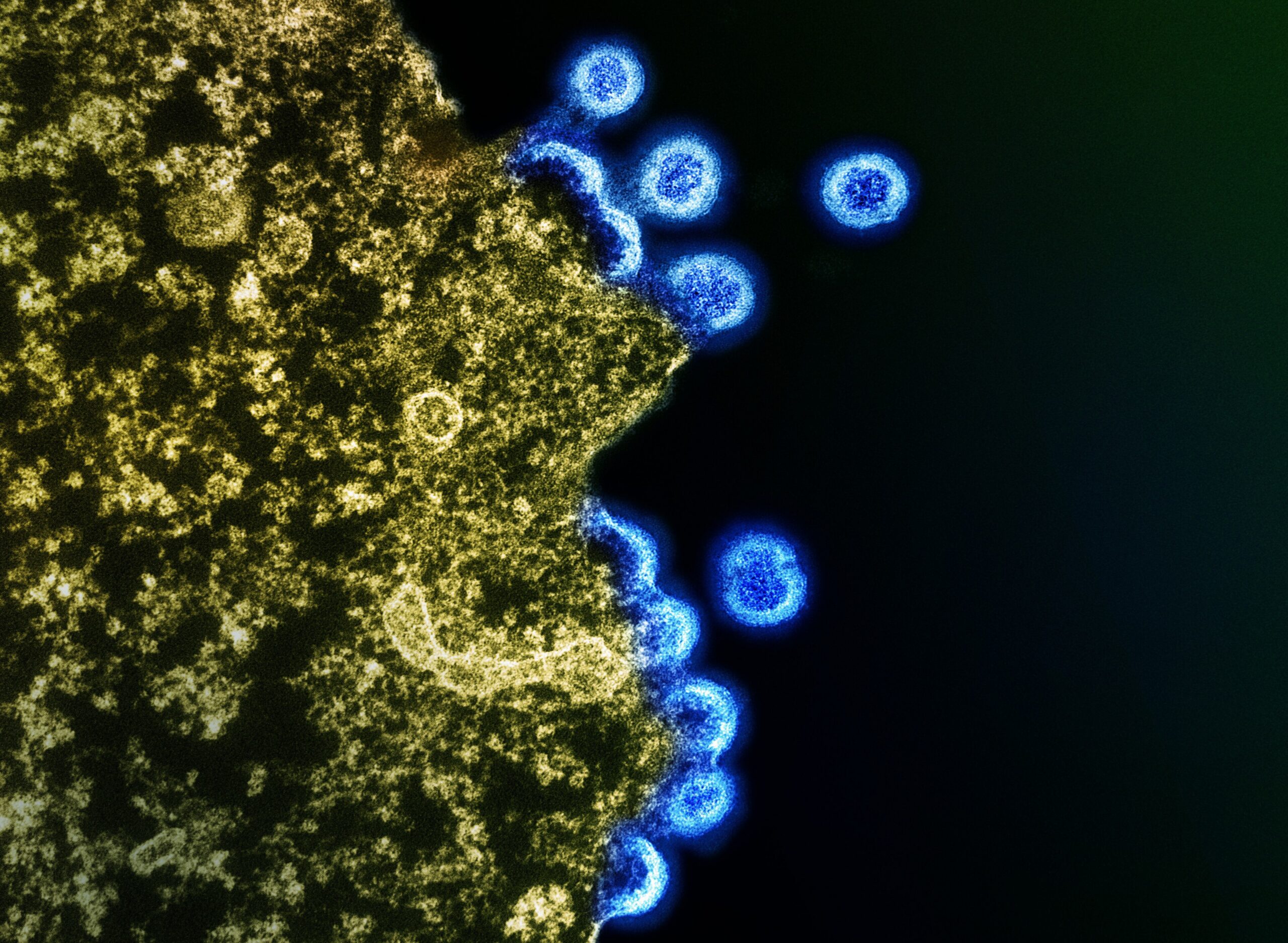 Evolution of Biological Information: HIV Evolution