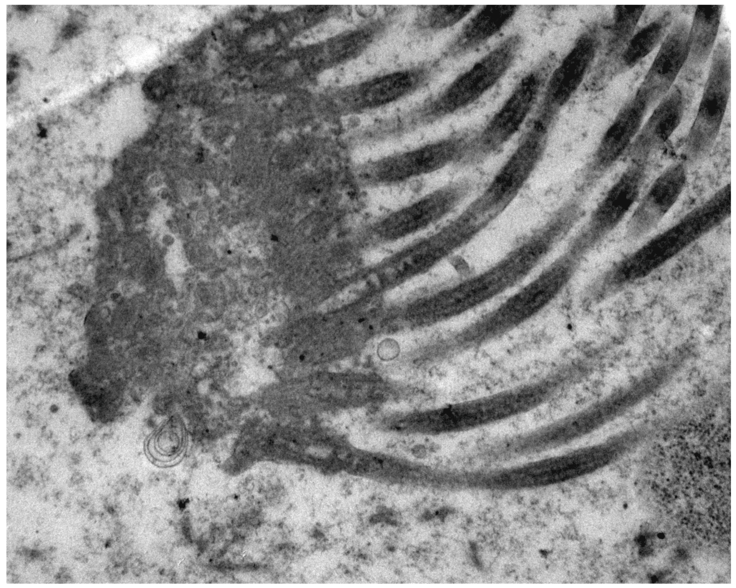 Galloping Flagella and Cilia Railroads
